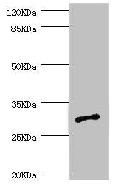 AGPAT2 Antibody
