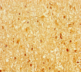 AHR Antibody