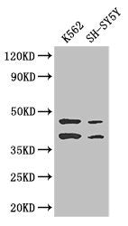 AIM2 Antibody