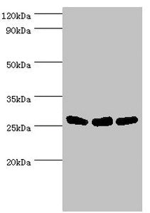 AK2 Antibody