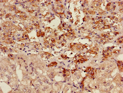 AKAP7 Antibody
