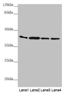 AKR7A2 Antibody