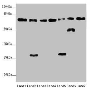 ALB Antibody