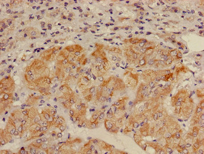 ALDH3B2 Antibody