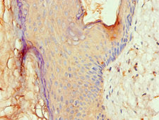ALOX15B Antibody