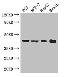 AMACR Antibody