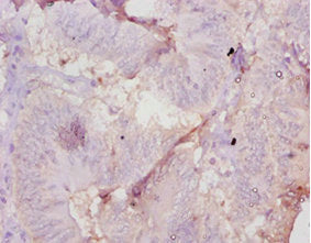 Amh Antibody