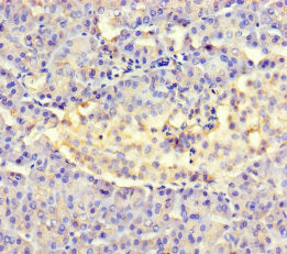 AMTN Antibody