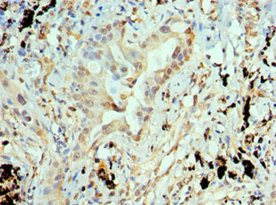 ANTXR1 Antibody