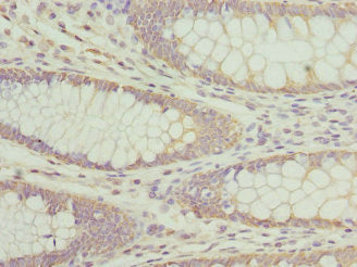 AP3B1 Antibody