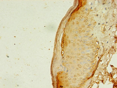 APAF1 Antibody