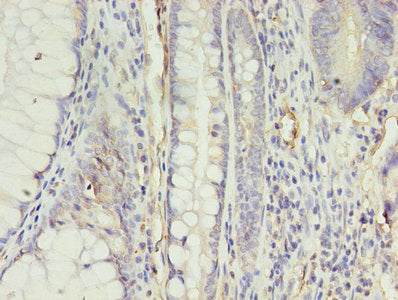 APLNR Antibody