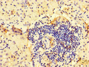 ARHGAP10 Antibody
