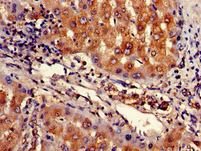 ARHGAP25 Antibody