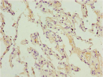 ARIH2 Antibody