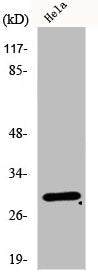 EIF3K Antibody