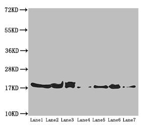 ATP5H Antibody