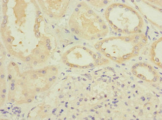 ATP6V0D1 Antibody