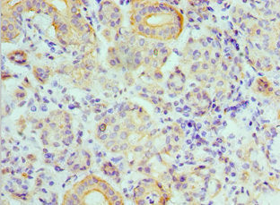 ATP6V1B1 Antibody