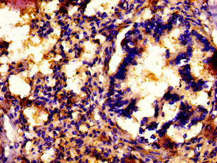 ATP7A Antibody