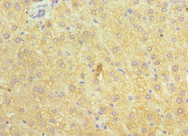 ATP7B Antibody