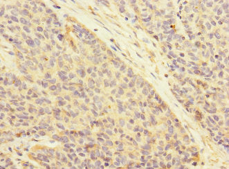 ATRN Antibody