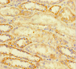 ATRX Antibody