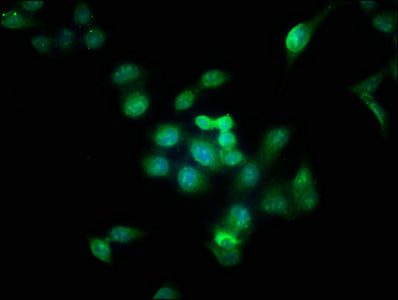 AURKB Antibody