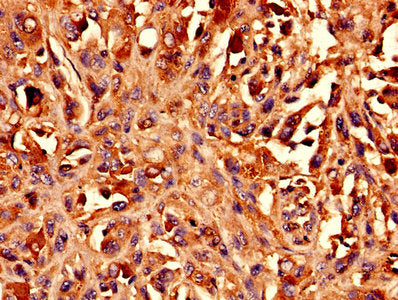 BCAT1 Antibody