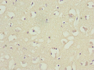 BFAR Antibody