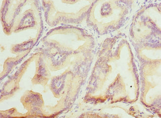 BLVRA Antibody