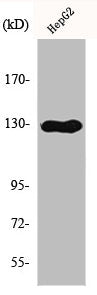 CSF2RB Antibody