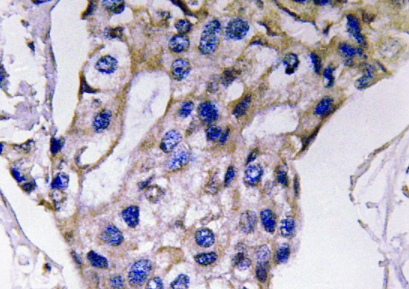IL5 Antibody