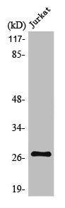 KCNMB2 Antibody