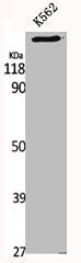 CDC42BPA Antibody