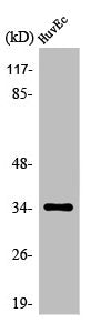 OR5AK3P Antibody
