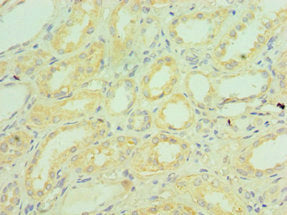 C1QB Antibody