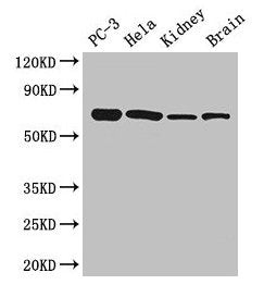 GPI Antibody