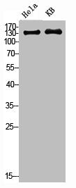 PDGFRB Antibody