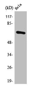 PPP2R1B Antibody