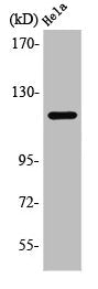PGR Antibody