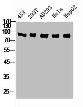 RPS6KA6 Antibody