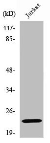 SOCS2 Antibody