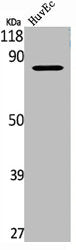 TLK1 Antibody