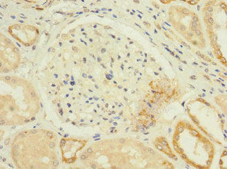 CACNA1H Antibody