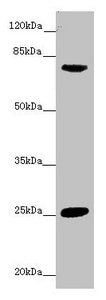 CACNB1 Antibody