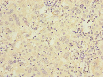 CACNG7 Antibody