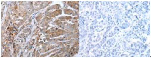 CALB2 antibody