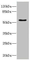 CALCR Antibody