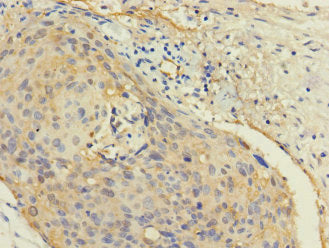 CALML3 Antibody